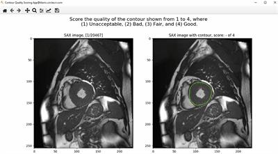 A Systematic Quality Scoring Analysis to Assess Automated Cardiovascular Magnetic Resonance Segmentation Algorithms